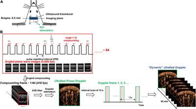 Vascular responses of penetrating vessels during cortical spreading depolarization with ultrasound dynamic ultrafast Doppler imaging